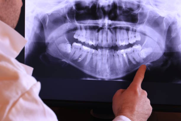 Best After-Hours Emergency Dentist in Goshen, IN