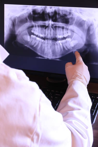 Best Emergency Dental Surgery in Goshen, IN